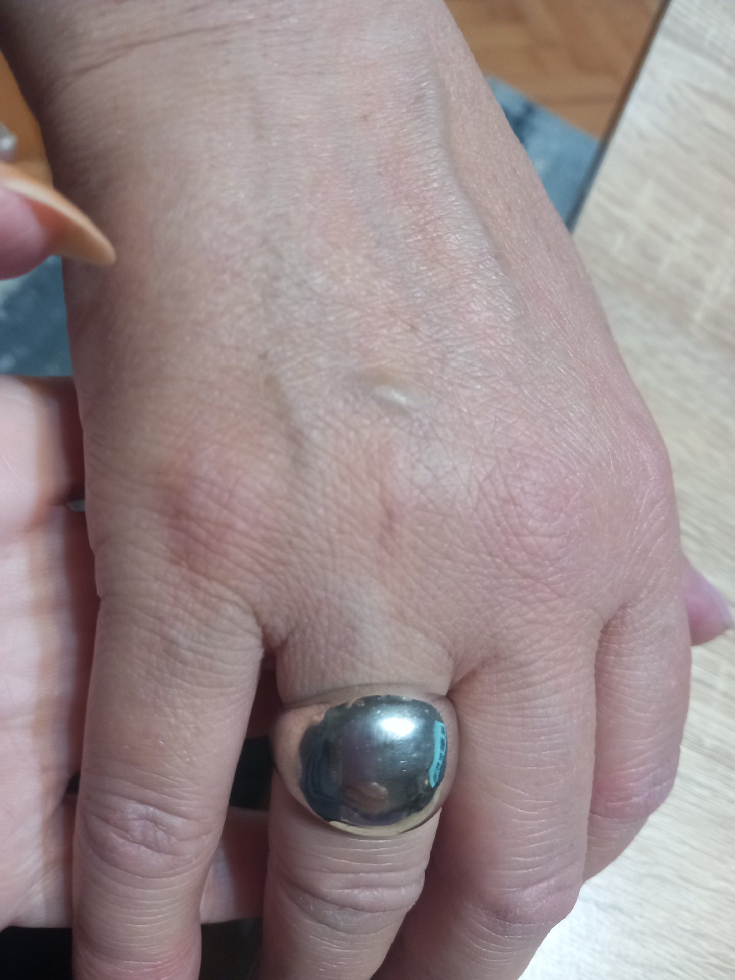 Zia prsten prilagodliv